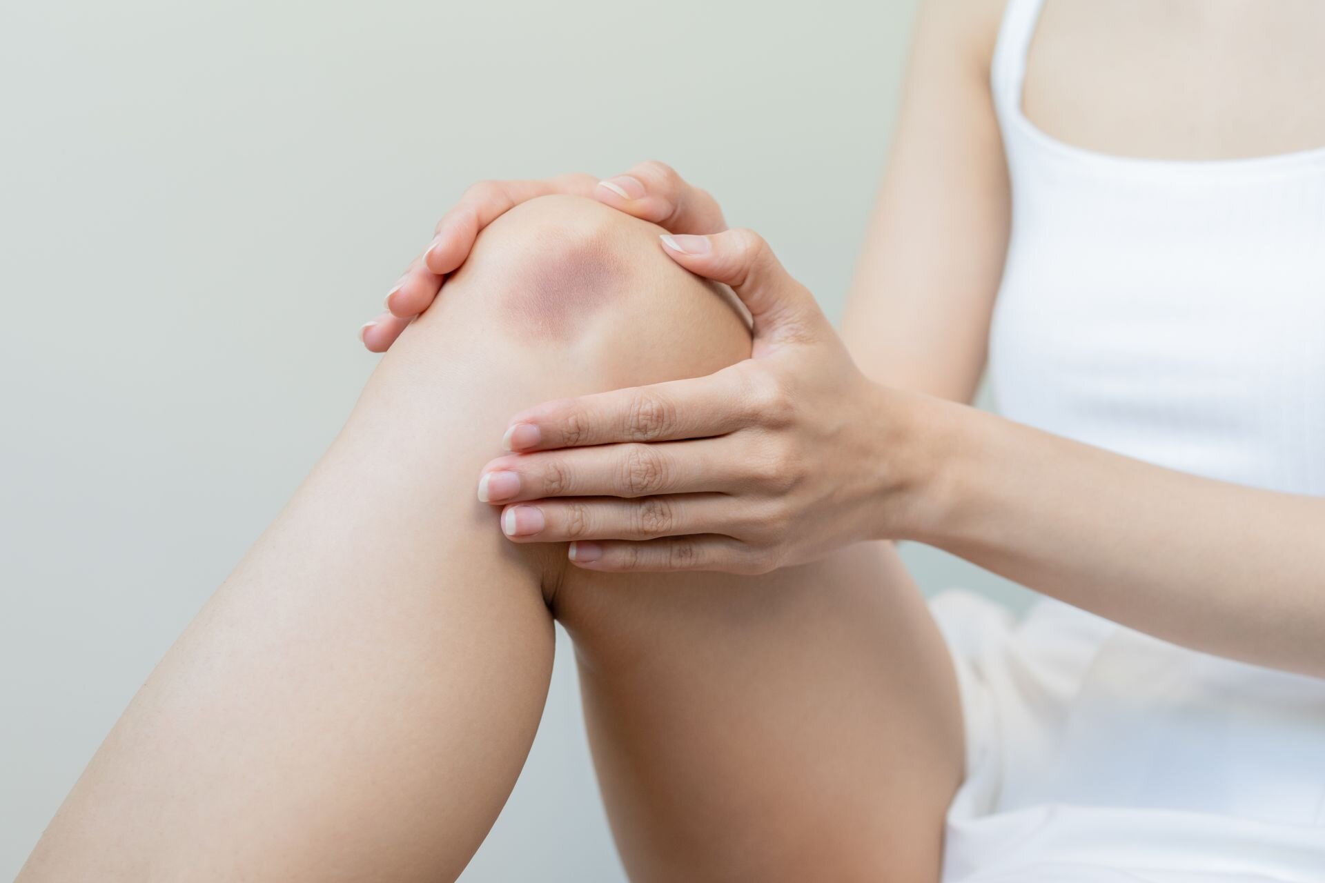 Frau hält sich ihr schmerzendes, angeschwollenes Knie mit sichtbarem Bluterguss – typisches Symptom bei Knietrauma, Prellung oder Bänderverletzung.